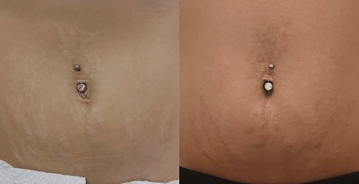 Skin Revive Studio AZ